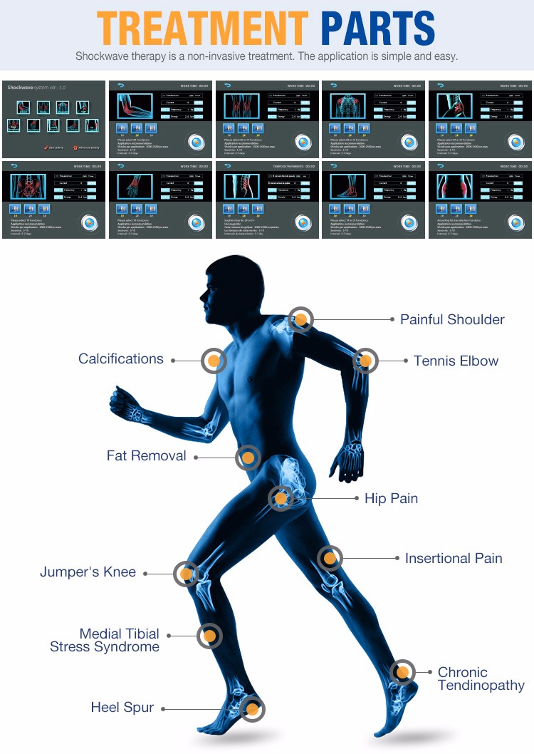 shock wave treatment.jpg